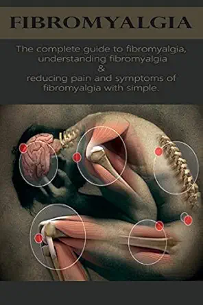 fibromyalgia the complete guide to fibromyalgia understanding fibromyalgia and reducing pain and symptoms of