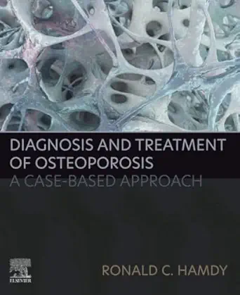 diagnosis and treatment of osteoporosis a case based approach 1st edition ronald c hamdy 0323995500,
