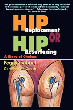 hip replacement or hip resurfacing a story of choices 1st edition peggy gabriel 1410765652, 978-1410765659