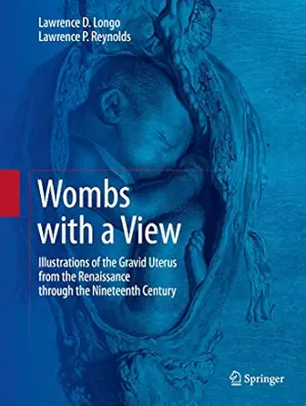 wombs with a view illustrations of the gravid uterus from the renaissance through the nineteenth century 1st
