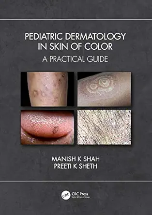 pediatric dermatology in skin of color a practical guide 1st edition manish k shah ,preeti k sheth