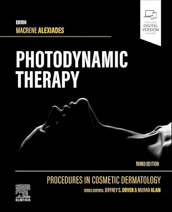 procedures in cosmetic dermatology series photodynamic therapy 1st edition macrene alexiades md phd