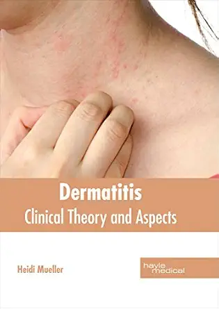 dermatitis clinical theory and aspects 1st edition heidi mueller 1632414481, 978-1632414489