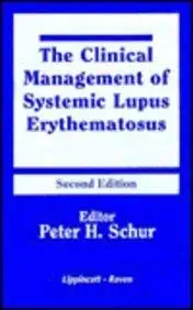 the clinical management of systemic lupus erythematosus 1st edition peter h schur 0397514735, 978-0397514731