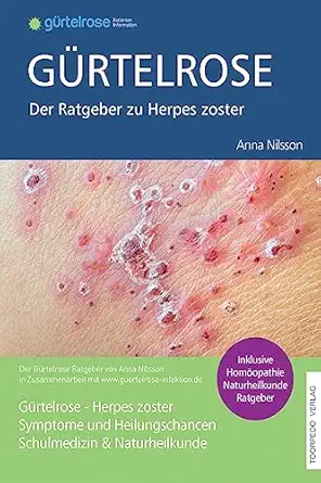 ga 1/4rtelrose der groa e ratgeber zu herpes zoster schulmedizin + naturheilkunde 1st edition fr anna nilsson