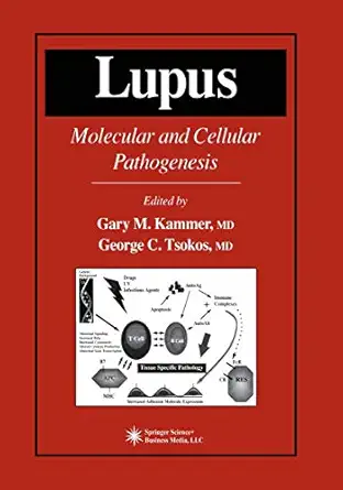 lupus molecular and cellular pathogenesis 1st edition gary m kammer 0896035565, 978-0896035560