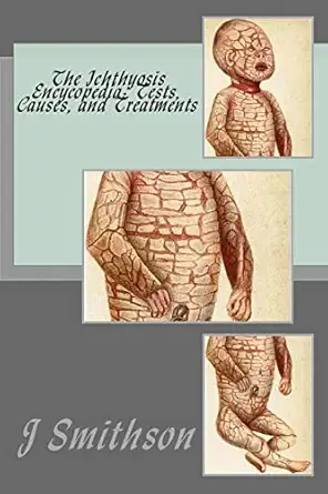 the ichthyosis encycopedia tests causes and treatments 1st edition j p smithson ma ,m awad md 1467926981,