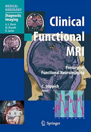 clinical functional mri presurgical functional neuroimaging 1st edition christoph stippich ,k sartor