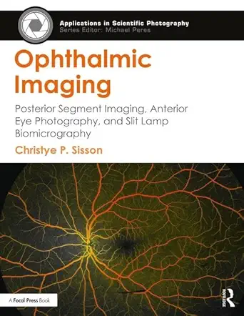 ophthalmic imaging posterior segment imaging anterior eye photography and slit lamp biomicrography 1st
