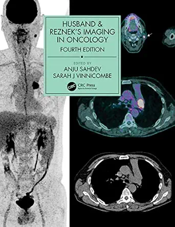 husband and rezneks imaging in oncology 1st edition anju sahdev ,sarah j vinnicombe 113830123x, 978-1138301238