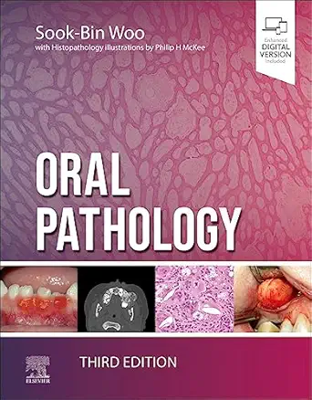 oral pathology 1st edition sook bin woo dmd mmsc 032382918x, 978-0323829182