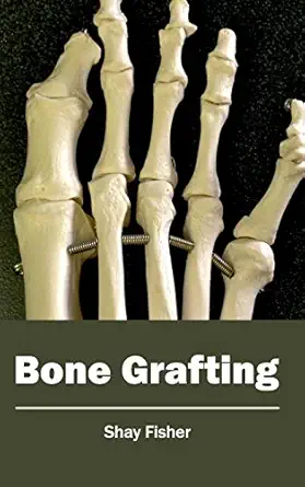 bone grafting 1st edition shay fisher 1632410605, 978-1632410603