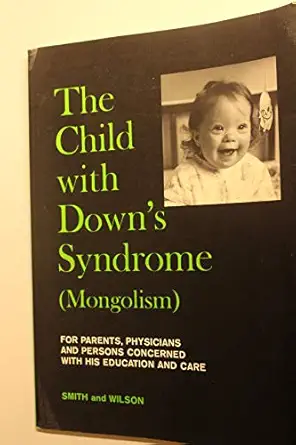 the child with downs syndrome causes characteristics and acceptance for parents physicians and persons