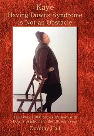 kaye having downs syndrome is not an obstacle 1 in every 1 000 babies are born with downs syndrome in the uk