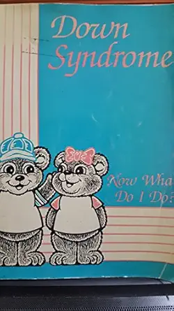down syndrome now what do i do 1st edition anne f squires ,andrew c squires ,sandra c davidson 0962639303,
