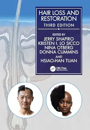 hair loss and restoration 1st edition jerry shapiro ,kristen lo sicco ,nina otberg ,donna cummins ,hsiao han
