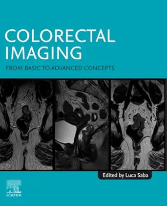 colorectal imaging from basic to advanced concepts 1st edition luca saba md 0443290482, 978-0443290480