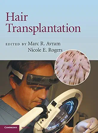 hair transplantation 1st edition marc r avram ,nicole e rogers md 0521879671, 978-0521879675