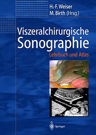 viszeralchirurgische sonographie lehrbuch und atlas 1st edition h f weiser ,m birth 364262958x, 978-3642629587