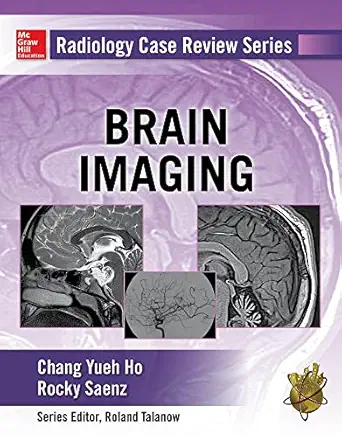 radiology case review series brain imaging 1st edition chang ho ,rocky saenz 0071826912, 978-0071826914