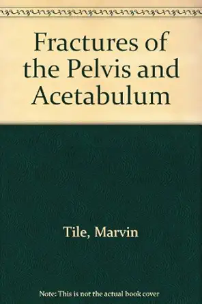 fractures of the pelvis and acetabulum 1st edition marvin tile 0683082493, 978-0683082494