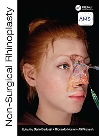 non surgical rhinoplasty 1st edition dario bertossi ,riccardo nocini ,ali pirayesh 1032303441, 978-1032303444