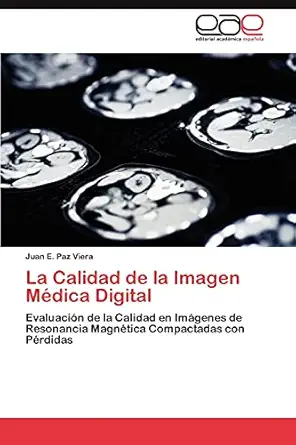 la calidad de la imagen madica digital evaluacia n de la calidad en ima genes de resonancia magnatica