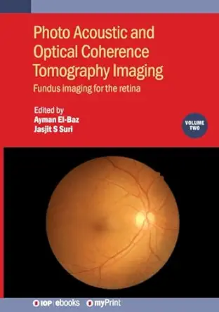 photo acoustic and optical coherence tomography imaging volume 2 fundus imaging for the retina 1st edition