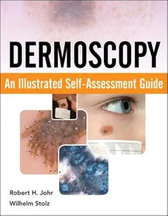 dermoscopy an illustrated self assessment guide 1st edition robert johr ,wilhelm stolz 0071613552,