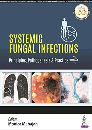 systemic fungal infections 1st edition monica mahajan 9389188342, 978-9389188349