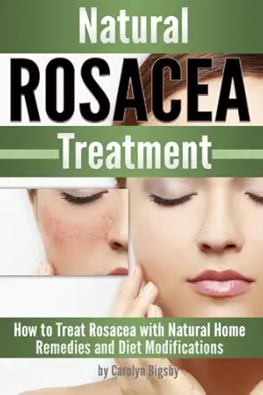 natural rosacea treatment how to treat rosacea with natural home remedies and diet modifications 1st edition