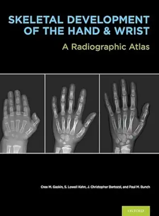 skeletal development of the hand and wrist a radiographic atlas and digital bone age companion 1st edition