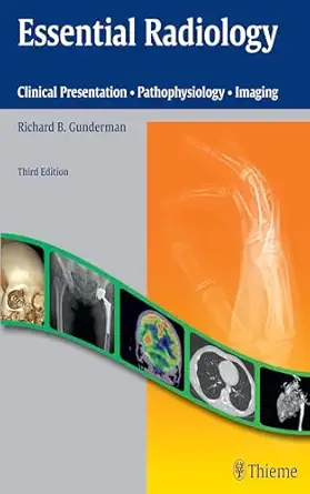 essential radiology clinical presentation a pathophysiology a imaging 1st edition richard b gunderman