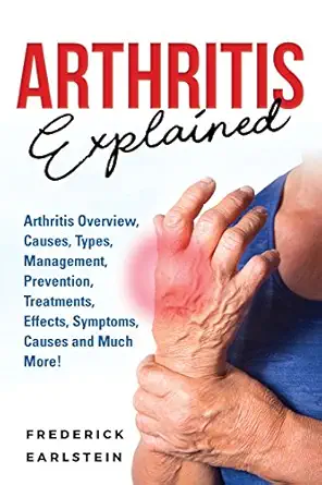 arthritis explained arthritis overview causes types management prevention treatments effects symptoms causes
