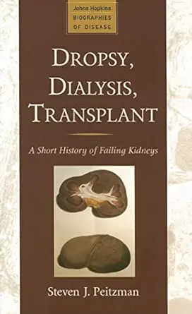 dropsy dialysis transplant a short history of failing kidneys 1st edition steven j peitzman 9780801887345,