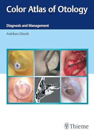 color atlas of otology diagnosis and management 1st edition anirban ghosh 9390553768, 978-9390553761