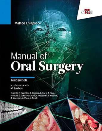 manual of oral surgery 1st edition matteo chiapasco 8821447561, 978-8821447563