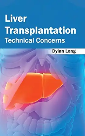 liver transplantation technical concerns 1st edition dylan long 1632422581, 978-1632422583