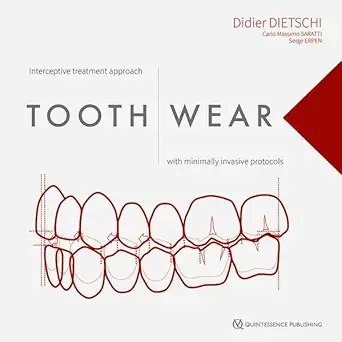 tooth wear interceptive treatment approach with minimally invasive protocols 1st edition didier dietschi