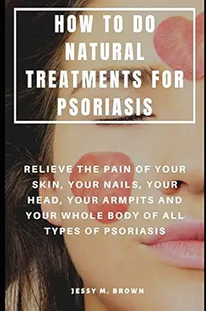 how to do natural treatments for psoriasis relieve the pain of your skin your nails your head your armpits