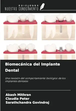 biomeca nica del implante dental una revisia n del comportamiento biola gico de los implantes dentales 1st