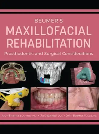 beumers maxillofacial rehabilitation prosthodontics and surgical considerations 1st edition arun sharma ,jay
