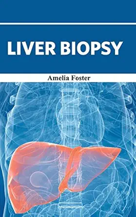 liver biopsy 1st edition amelia foster 1632422565, 978-1632422569