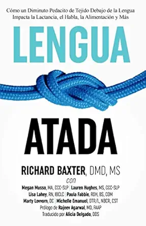 lengua atada ca mo un diminuto pedacito de tejido debajo de la lengua impacta la lactancia el habla la