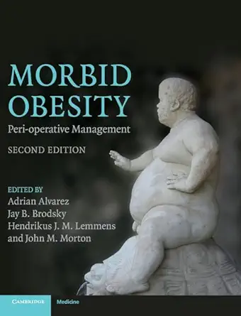 morbid obesity peri operative management 1st edition adrian alvarez ,jay b brodsky ,hendrikus j m lemmens