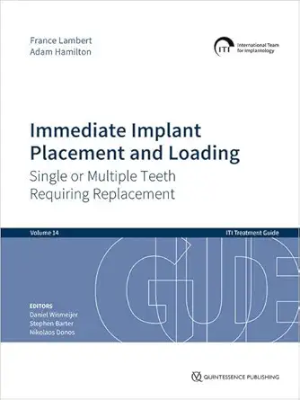 immediate implant placement and loading single or multiple teeth requiring replacement 1st edition france