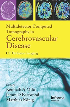 multidetector computed tomography in cerebrovascular disease ct perfusion imaging 1st edition kenneth miles