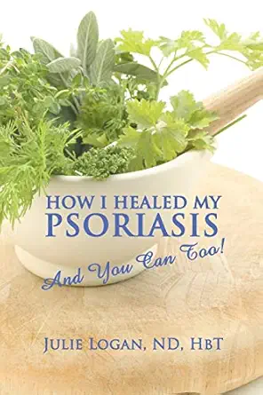 how i healed my psoriasis and you can too 1st edition julie logan nd hbt 1609760557, 978-1609760557