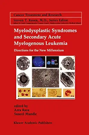 myelodysplastic syndromes and secondary acute myelogenous leukemia directions for the new millennium 1st