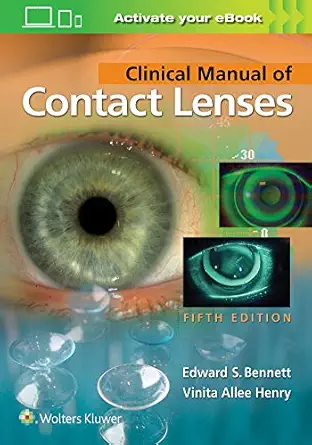 clinical manual of contact lenses 1st edition edward s bennett od ,vinita allee henry od 1496397797,